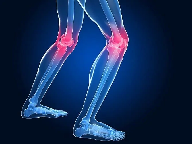 Übersäuerung und Arthrose | Wissenschaftl. Fakten & Tipps